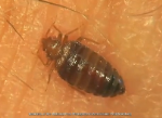 Bed Bug Feeding on Human Skin — PestWorld Bed Bug Information 