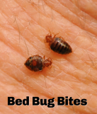 Bed bug bites- [NEWS-&amp;-VIEWS-HEALTH-HUB] -Pest Media