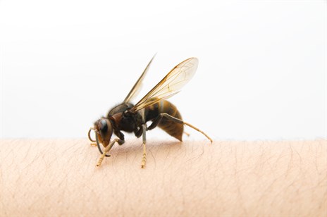 Bee Stings