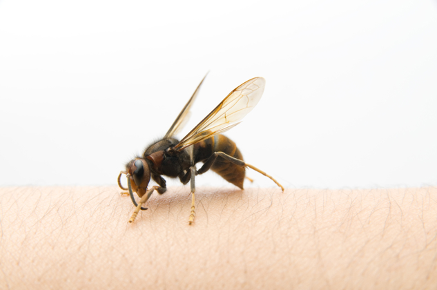Wasp Sting: Reaction Symptoms, Treatments, and Remedies