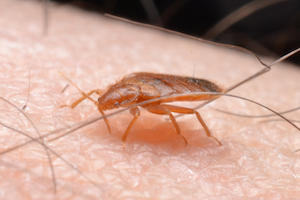 bed bug feeding on skin.jpg