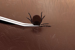 !TICK TWEEZERS.jpg