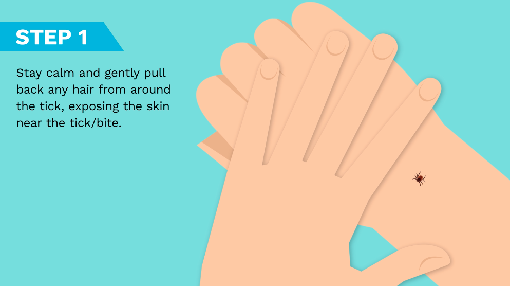 How to Properly Remove a Tick Advice on Tick Removal