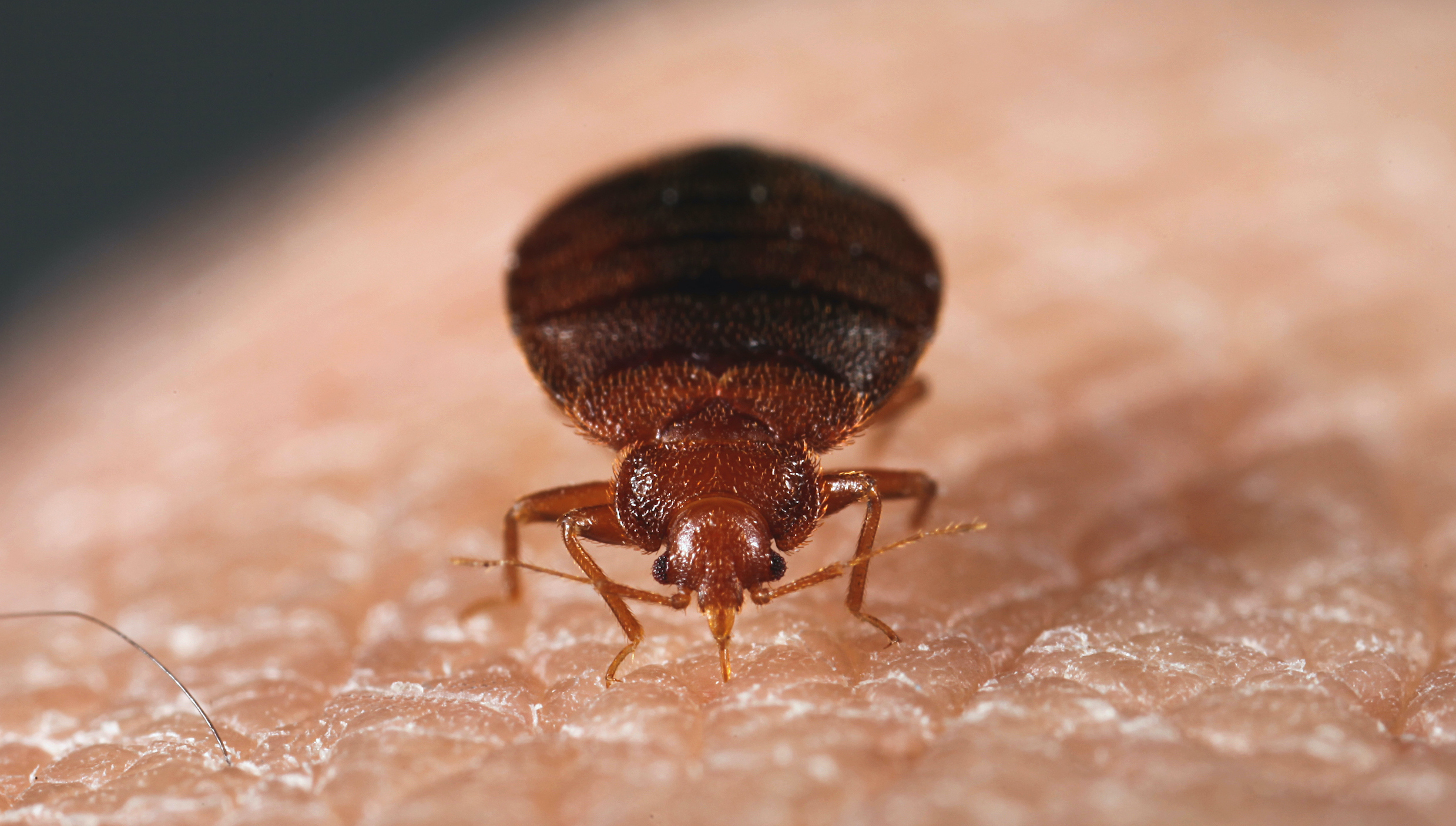 How Long Do Bug Bites Linger?